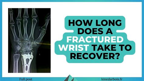 wrist fracture surgery recovery